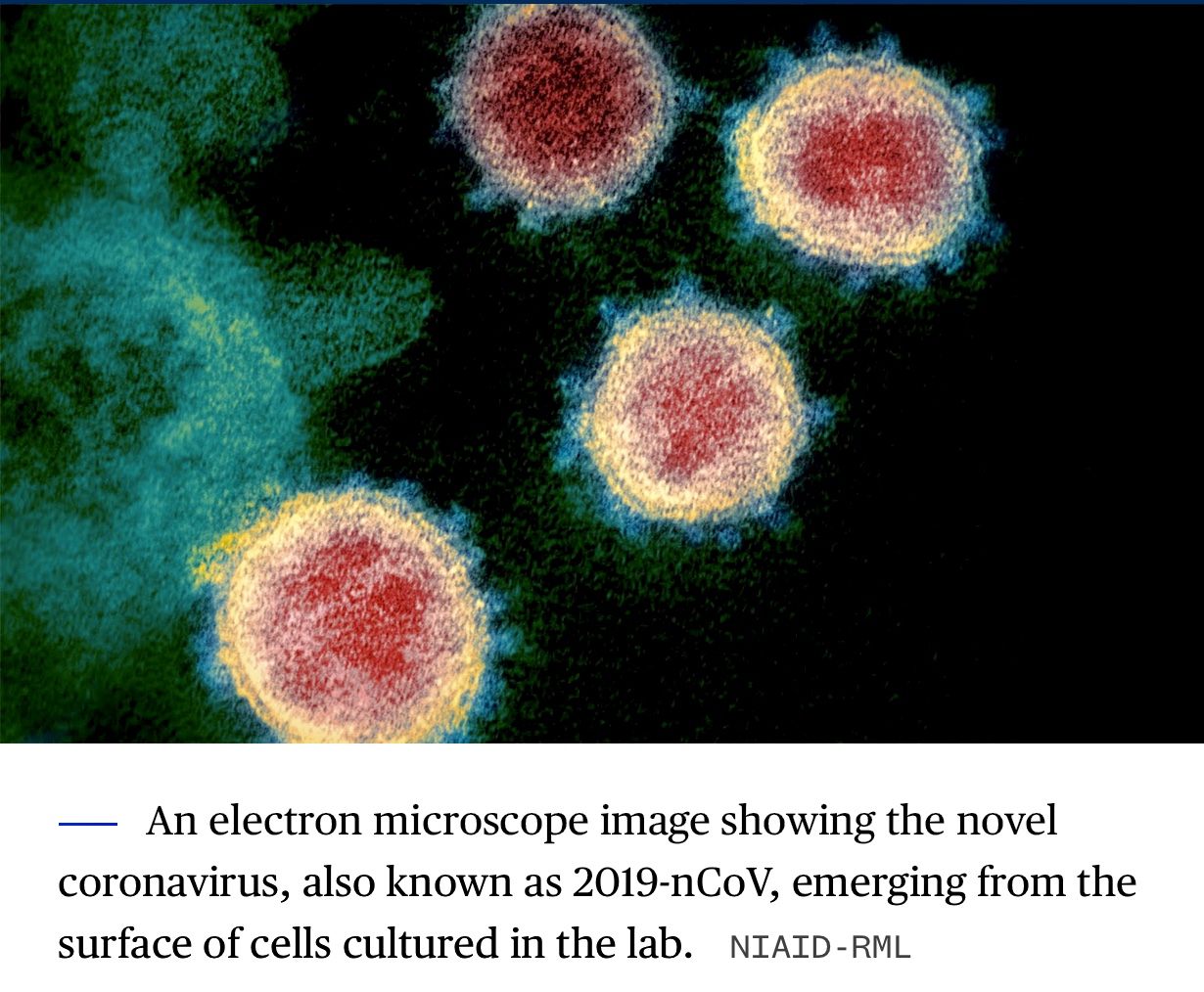 Op-ed on Coronavirus by Natalie Keshing 897 Views